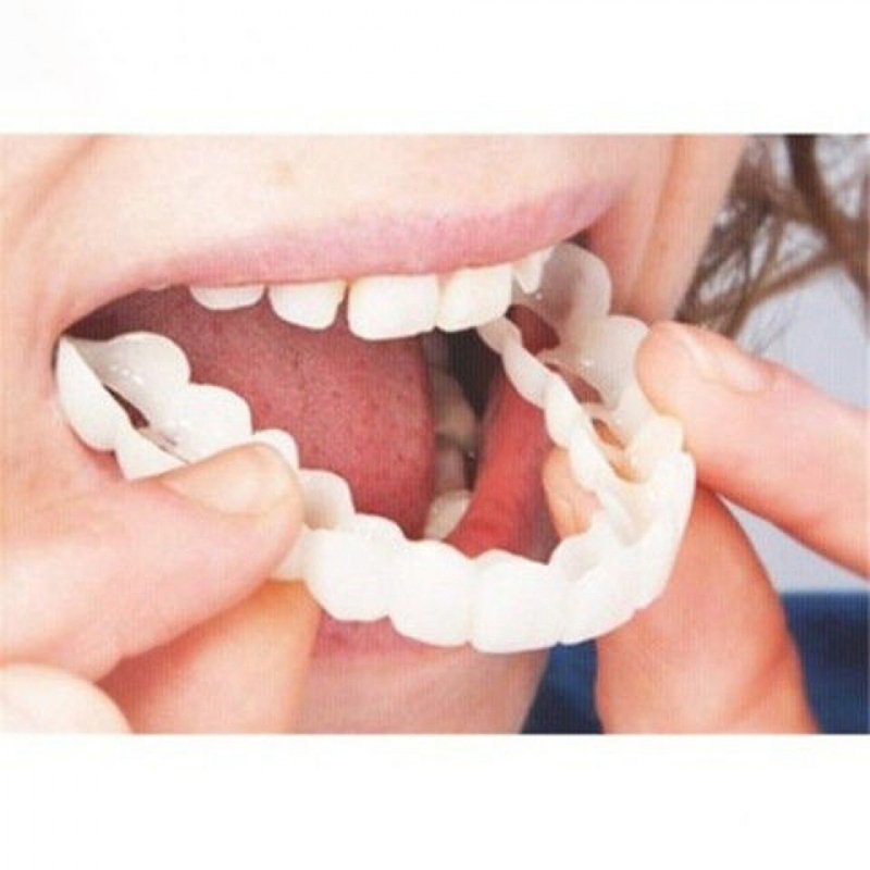 Teeth Whitening For Braces - Ajustement parfait couverture de fausses dents