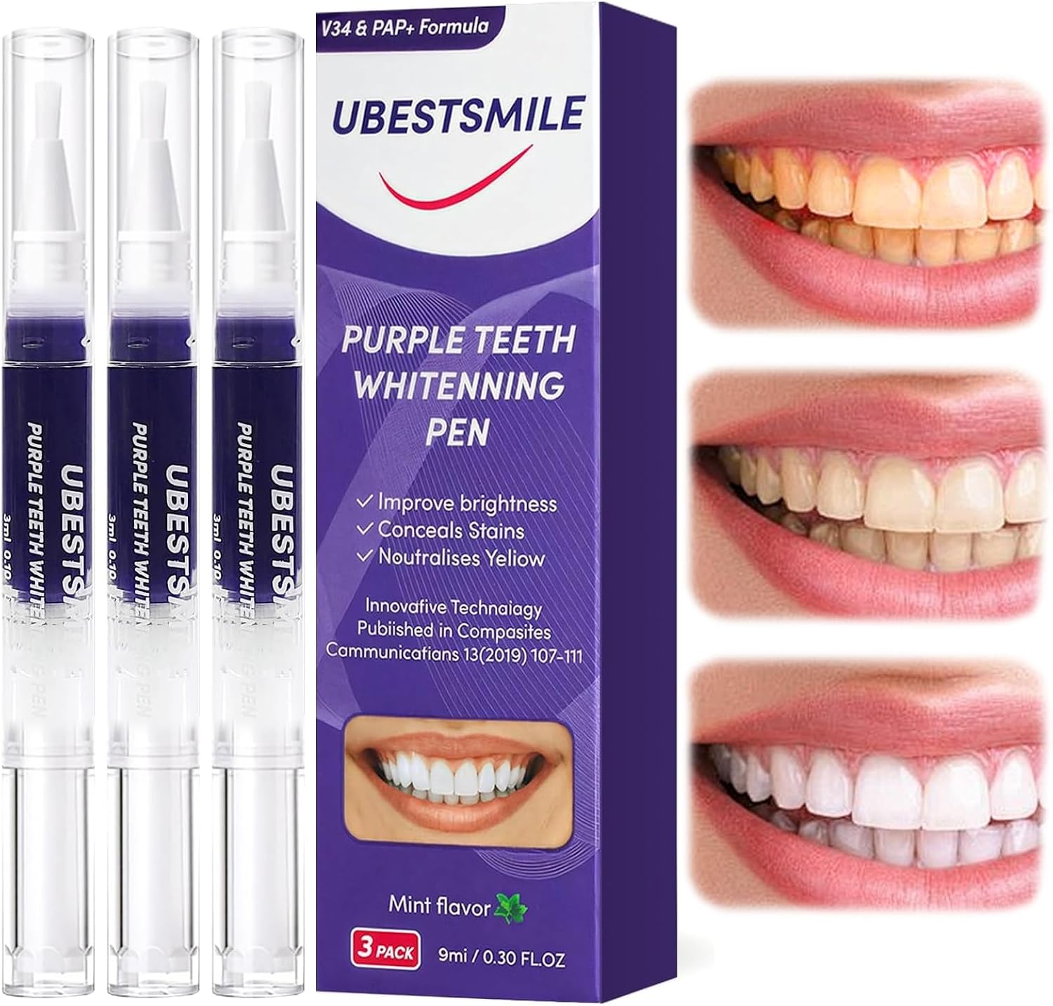 Teeth Whitening Pen - UBESTSMILE V34&PAP+ Formula Purple Teeth Whitening