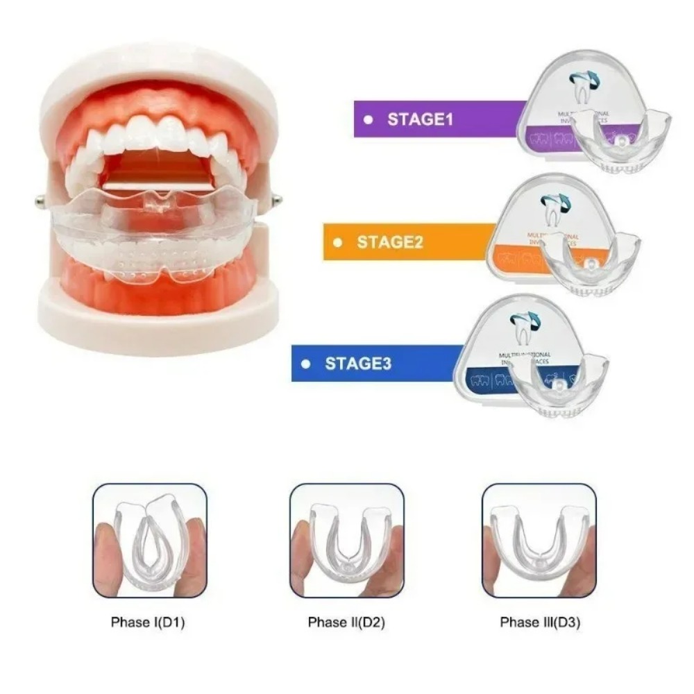 Teeth Whitening For Braces - Appareil orthodontique de redressement dentaire, gouttière